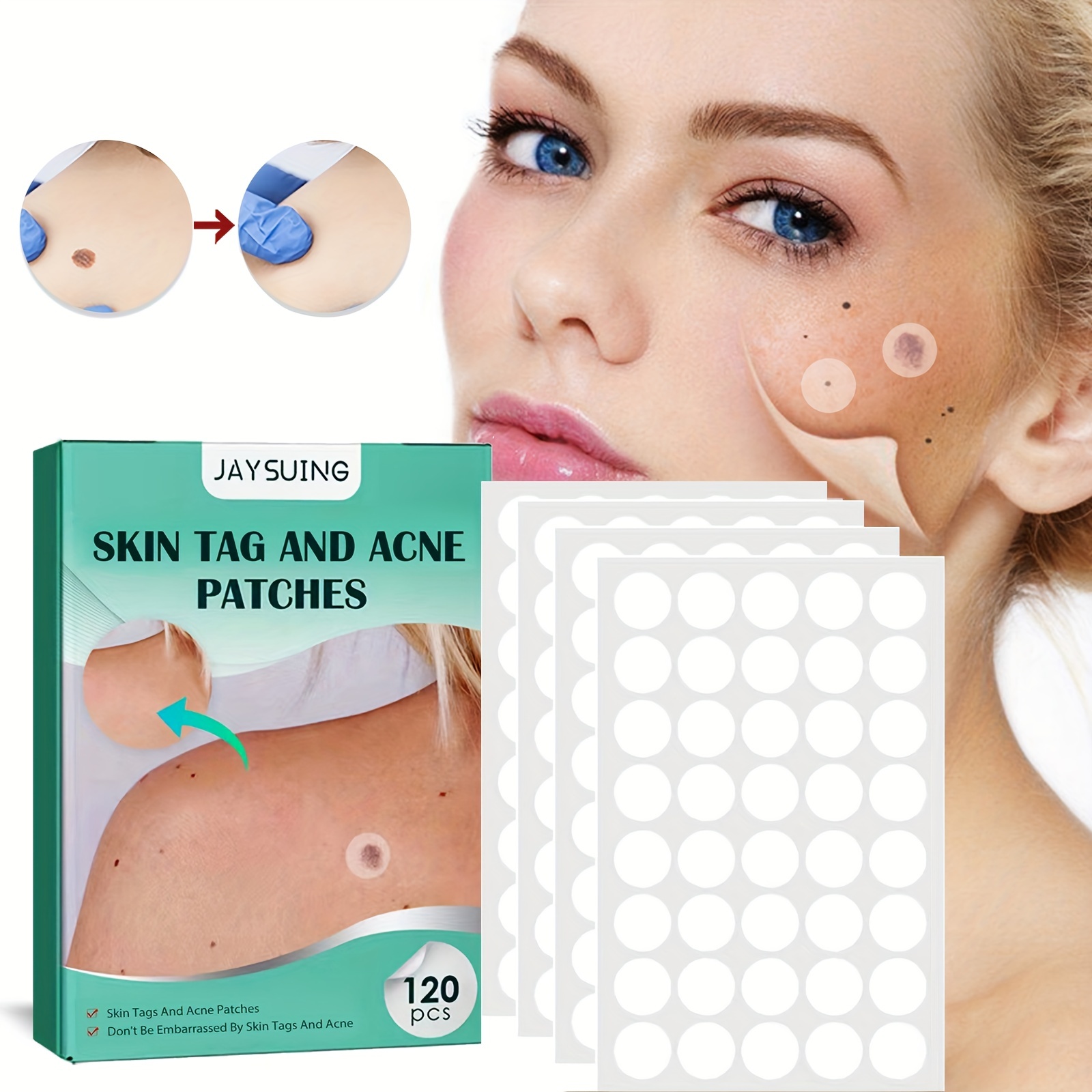 

120pcs Acne Patches, Hydrocolloid Acne Pimple Patch For Covering Zits And Blemishes, Spot Stickers For Face Skin Mild And Non-irritating Invisible Patch