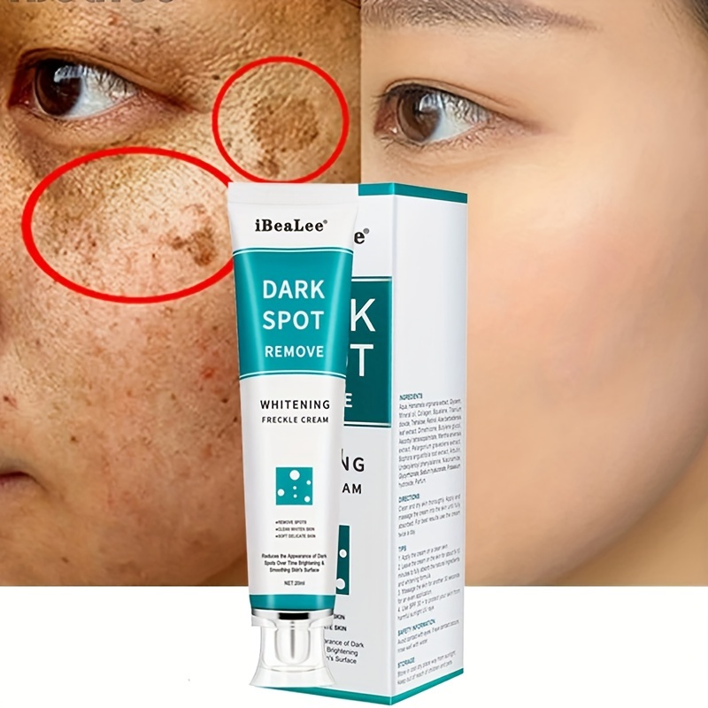 Freckle Cream - Firming Skin to Improve Tone & Remove Dark Spots