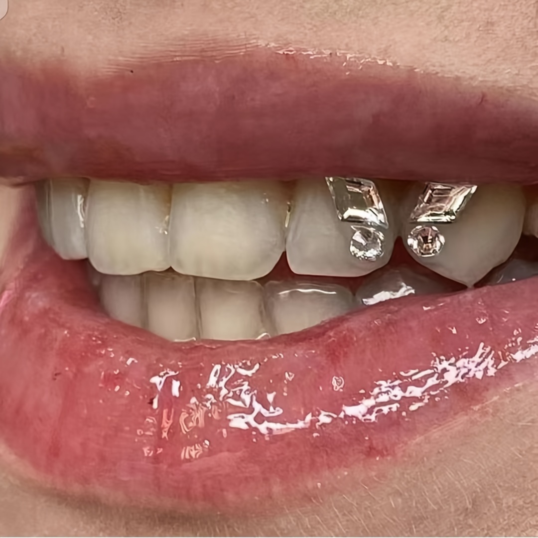 Tooth Gems Crystals - Temu