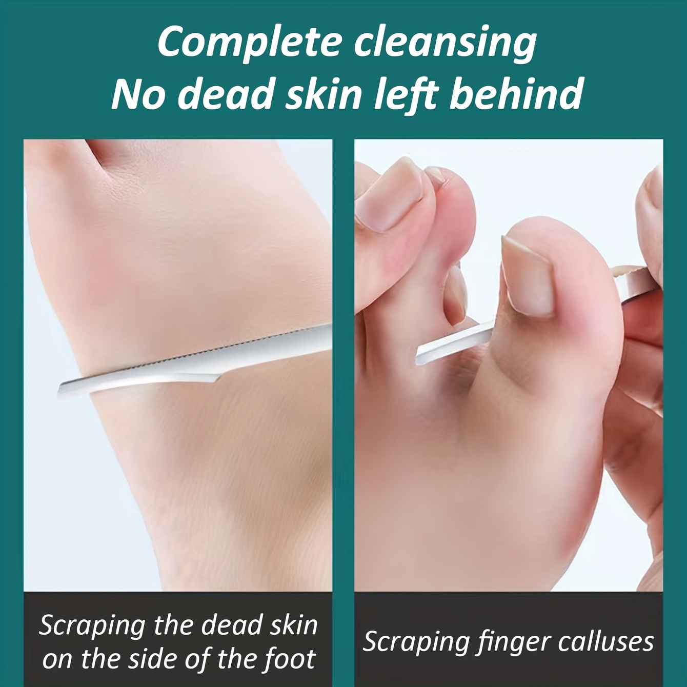 Pedicure Knife Tools Kits, Professional Stainless Steel Foot Scrubber Dead  Skin Remover,6 Pcs Foot Scraper Knife to Remove Dead Skin Callus Knife