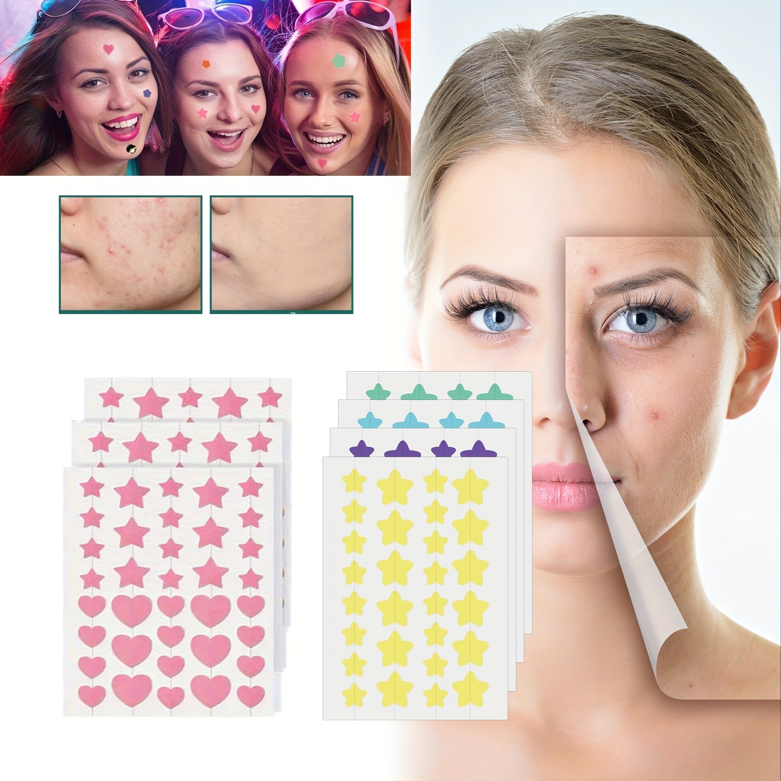 Acne Patch Pimple Patch Black Star Shaped Acne Absorbing - Temu