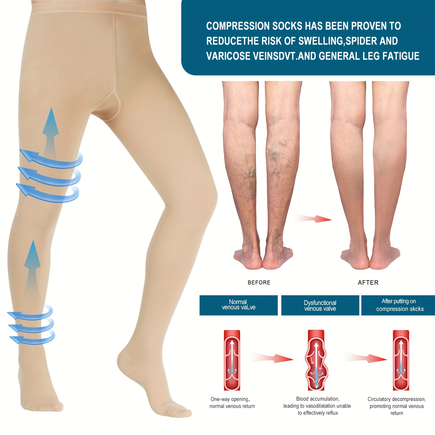 2 Pairs Compression Pantyhose Women Varicose veins Stockings
