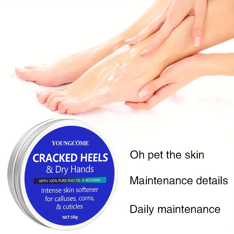 Cracked heels and hot sale dry hands