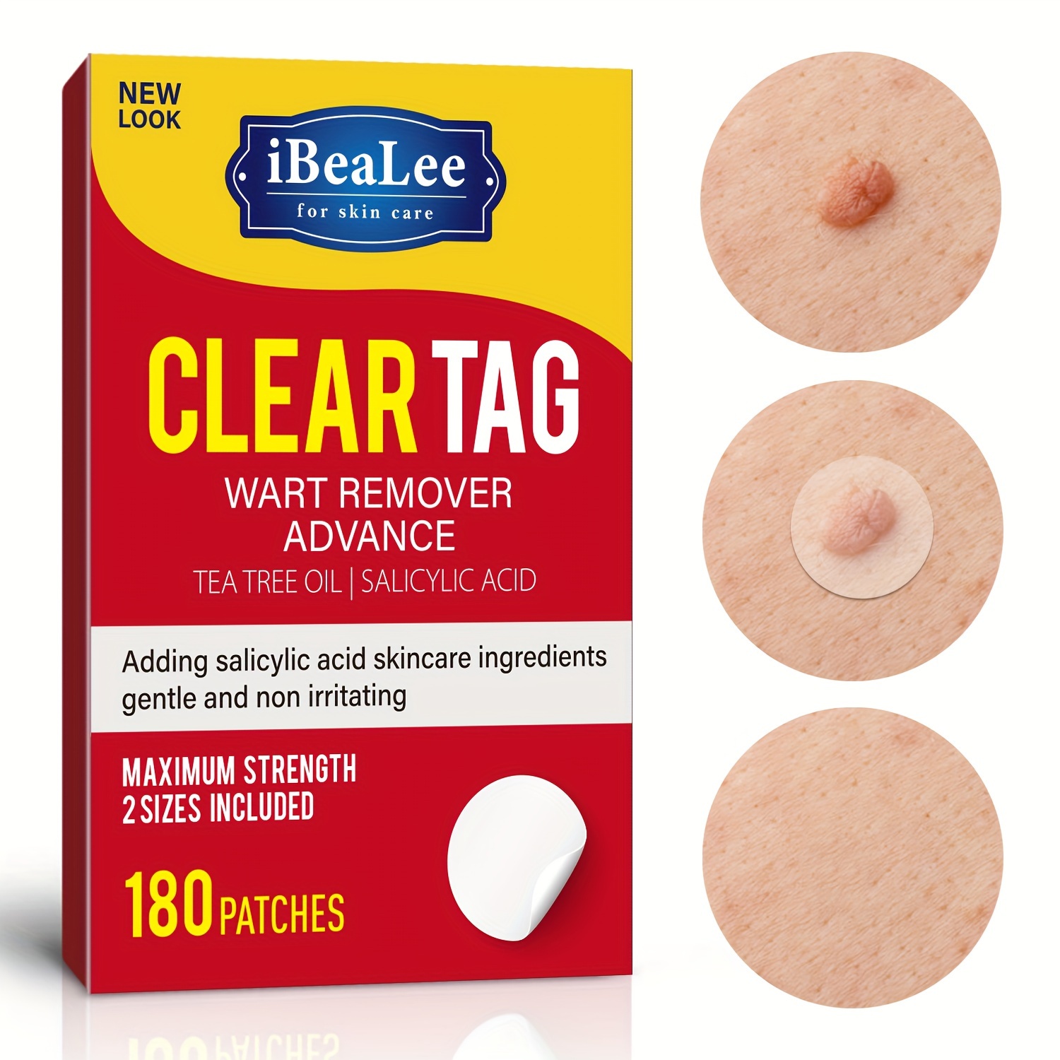 540/180 Pieces Easy To Use Skin Tag Patches For Covering Moles, Warts, And  Corns - Ideal For Hands, Knees, Feet, And Other Body Parts - Effectively Tr