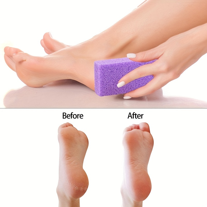 2PCS Natural Pumice Stone, Asqraqo Lava Pedicure Tools Hard Skin Callus  Remover For Feet And Hands - Foot File Exfoliation To Remove Dead Skin, And