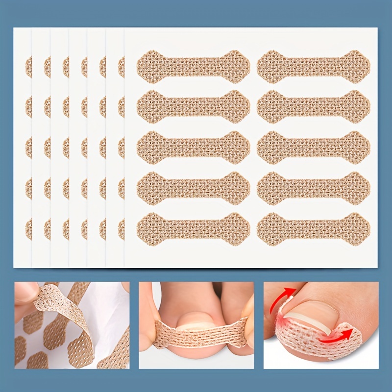 Silicone Nail Tools Stickers Toenail Correction Straightener