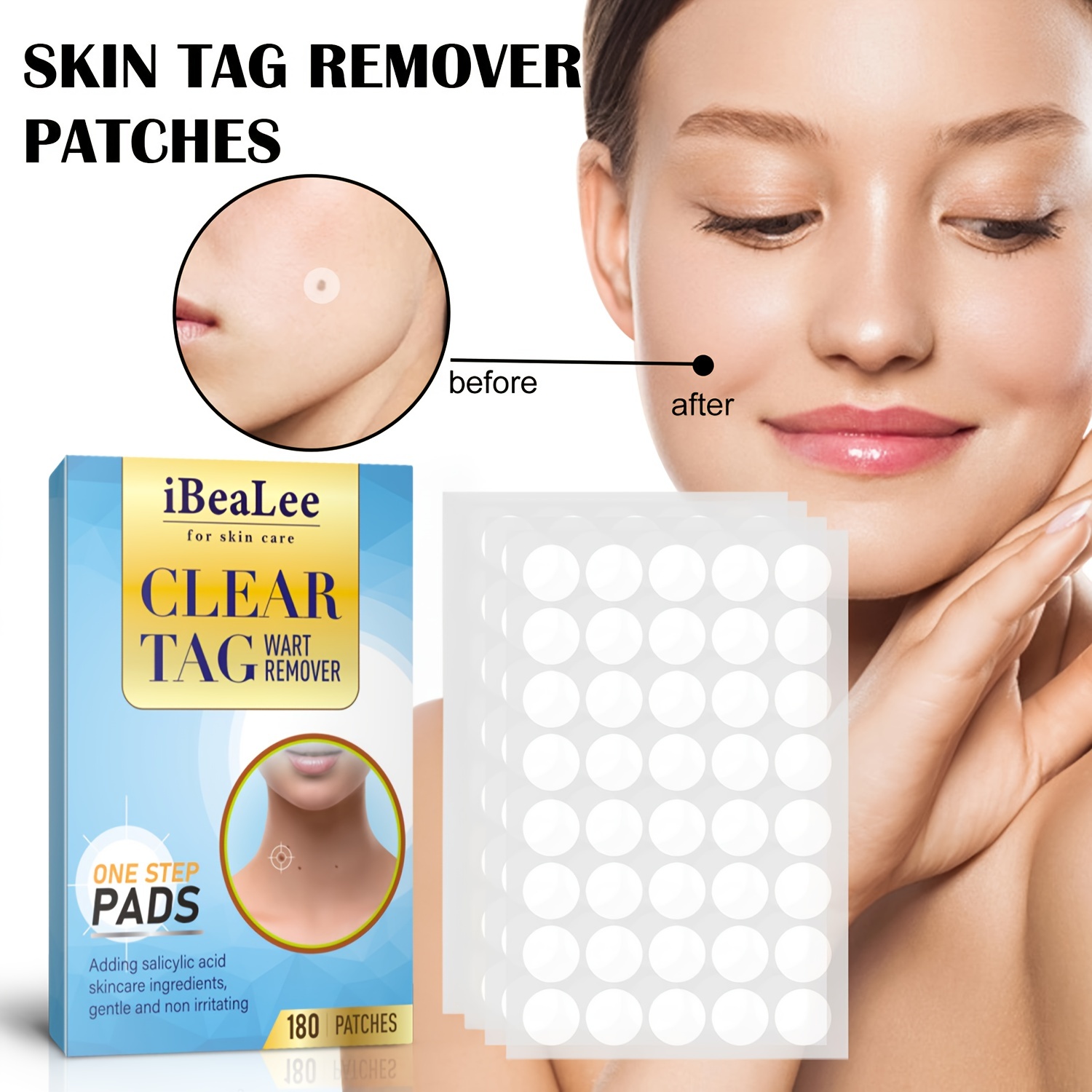 Ibealee Tag And Wart Remover, Skin Tag Removal Natural Skin