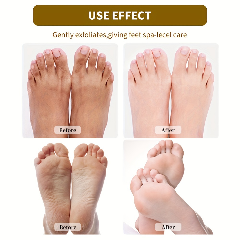 Rough on sale foot treatment