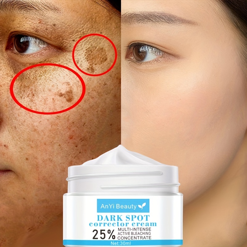 fading dark spots on face