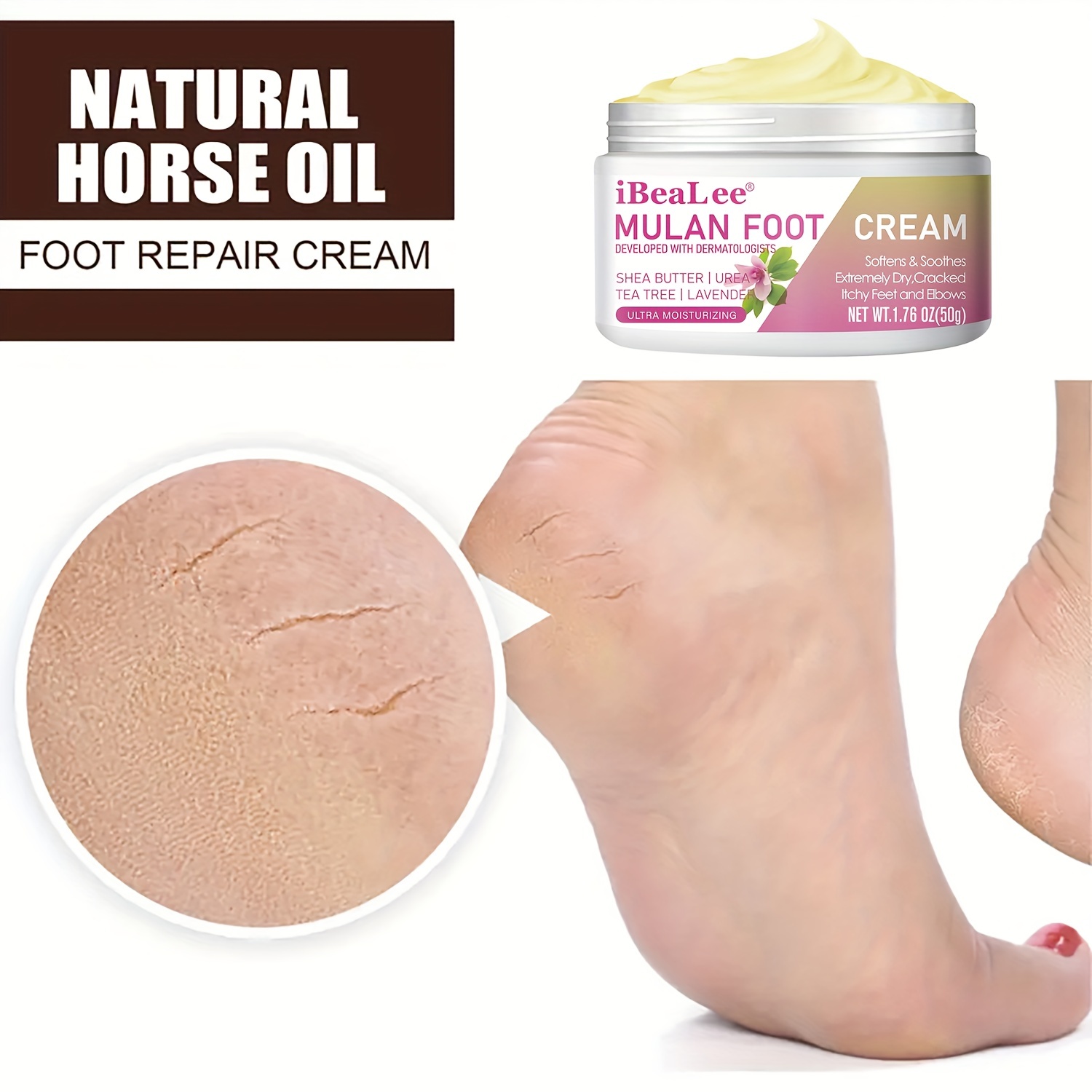 Anti Fungal Foot Repair Foot Cream Dead Skin Removal Peeling Moisturizing  Exfoliation Foot Care Tea Tree Oil Repair Cream for Cracked Heels - China  Foot Cream and Tea Tree Oil Foot Cream