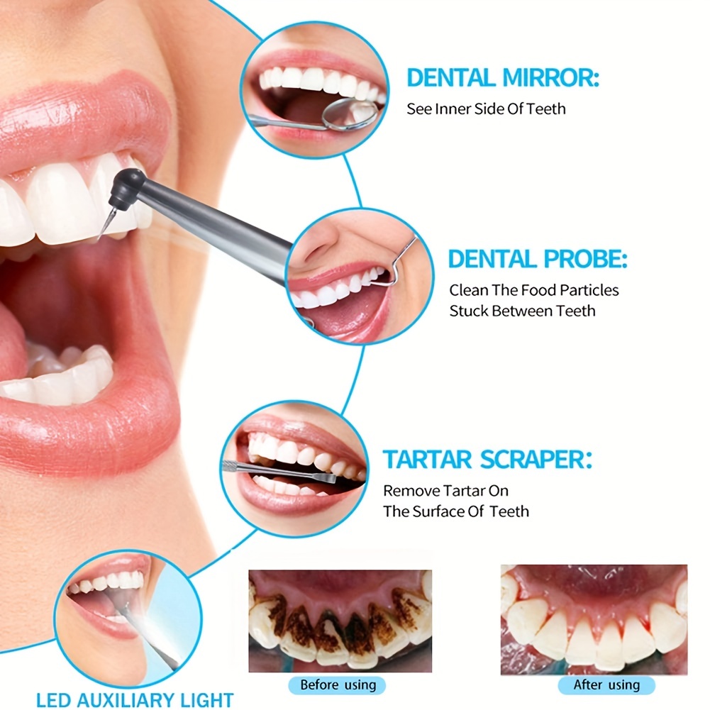 Portable Sonic Tartar Plaque Stain Remover for Teeth Cleaning - Electric Dental Calculus Remover with Tartar Removal Brush - Effective Teeth Cleaning Tool Kit