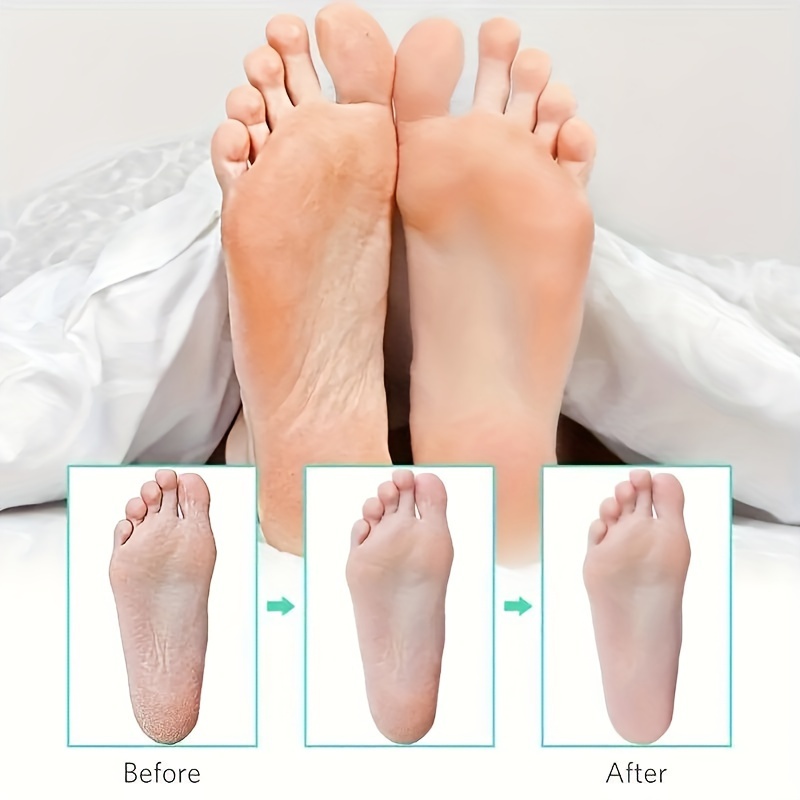 Professional Pedicure Planer Foot Planer remove Dead Skin - Temu