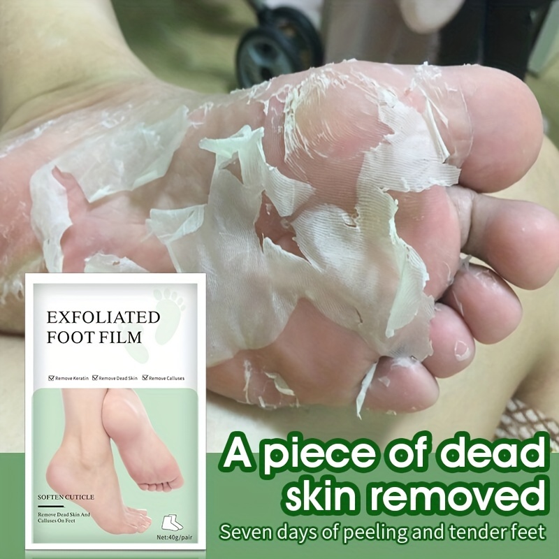 Foot Peel Mask - Exfoliator Peel Off Calluses Dead Skin Callus Remover -  Skinbae Co
