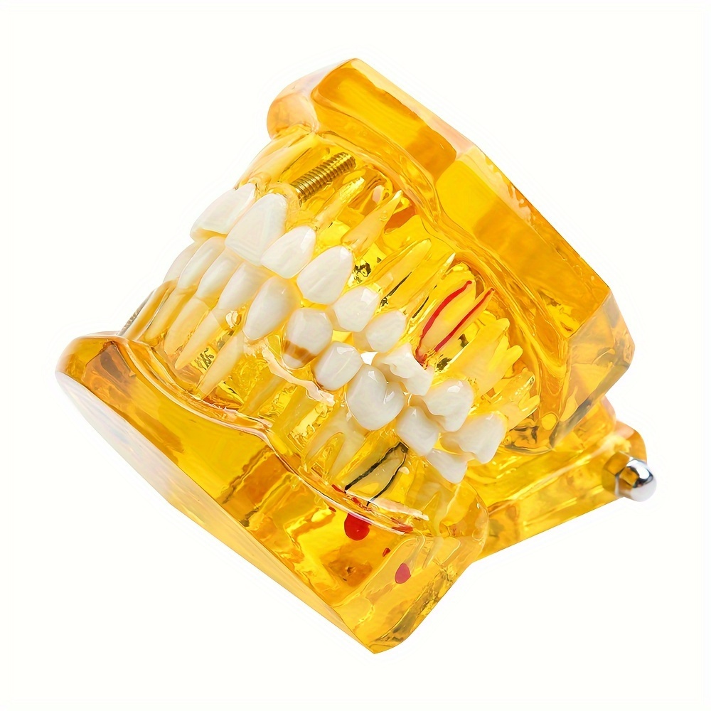 Dental Implant Model, Removable Dental Restoration Model