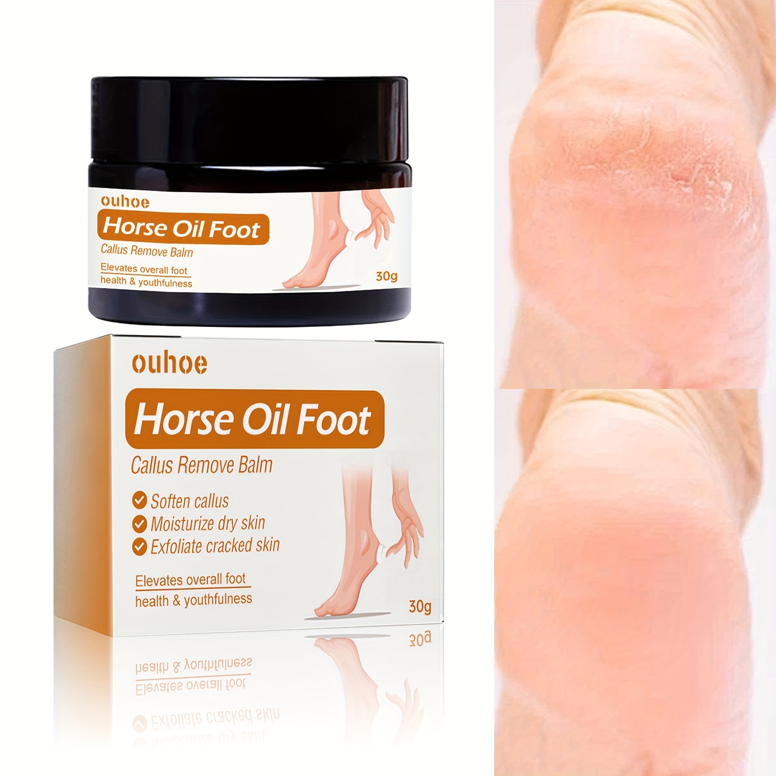 Horse Oil Foot Cream callus Removal Balm moisturize And - Temu