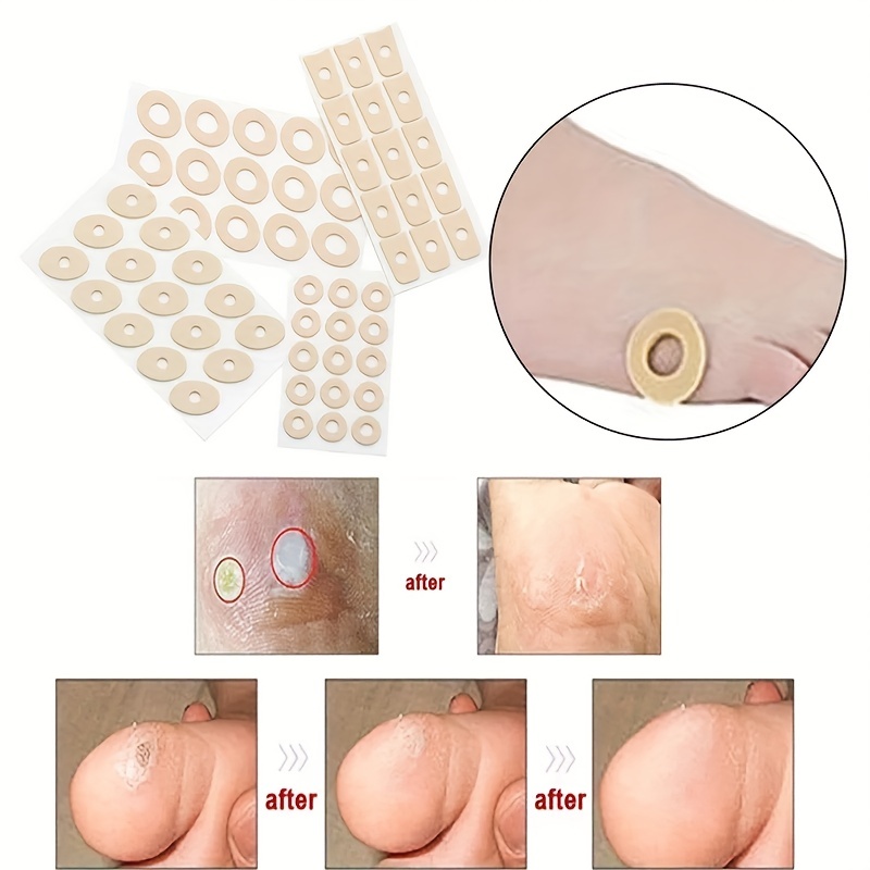 105pcs Reppkyh Callus Pads Corn & Toe Protectors Foot Care
