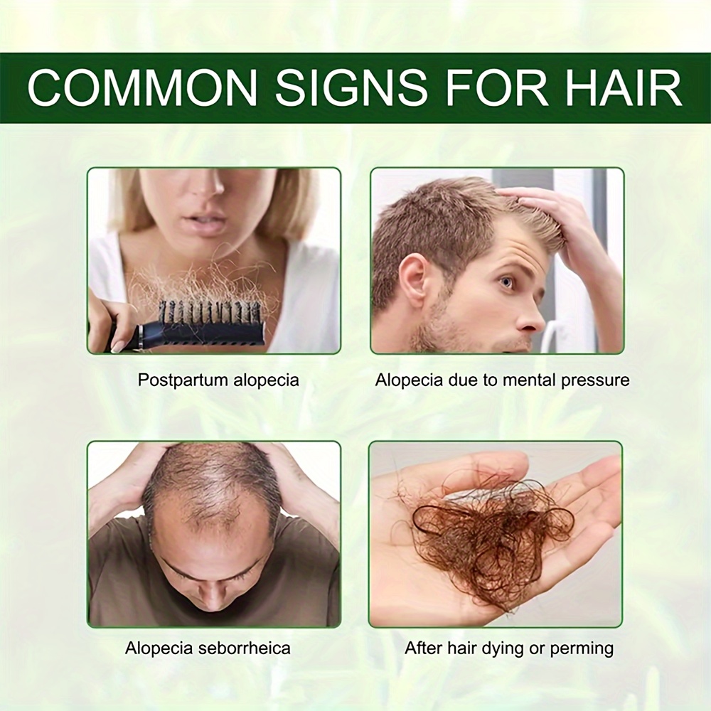 Rosemary Mint Scalp And Hair Strengthening Oil Hair Care - Temu