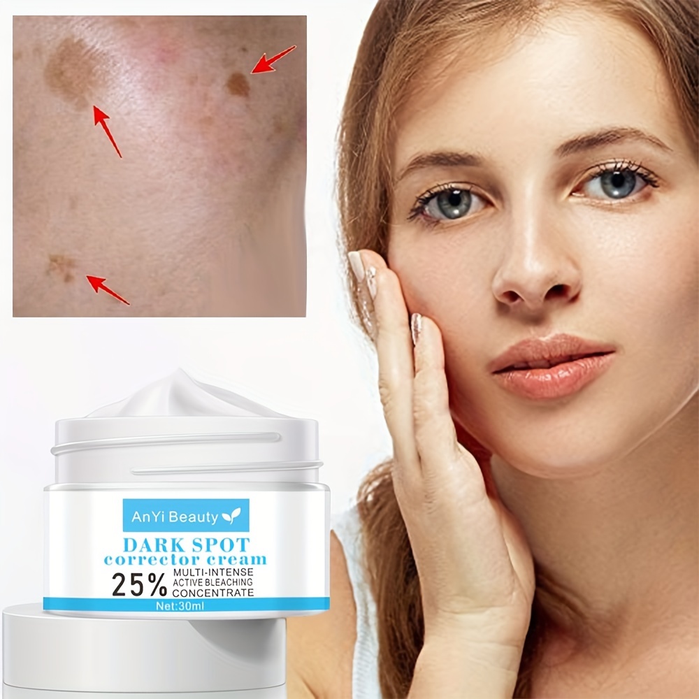 Dark Spot Remover for Face and Body, Dark Spot Corrector for Face, Sun Spots  Melasma Cream and Freckle Remover- Formulated with Arbutin, Niacinamide &  Vitamin E