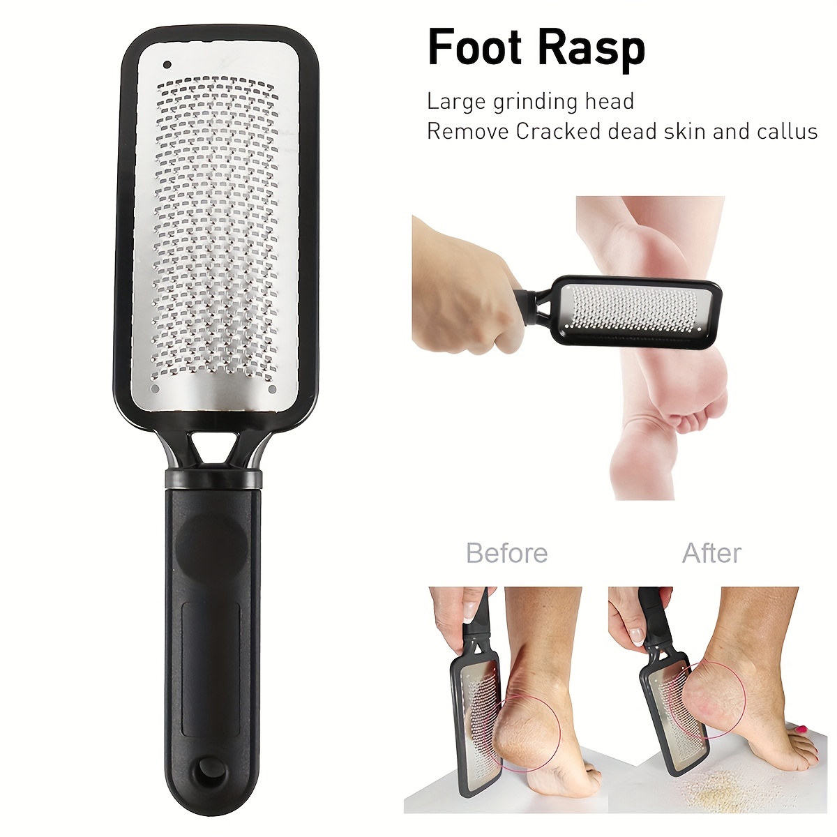 Foot Scrubber Callus Remover, Pedicure Metal Tool Heel Foot Scraper for Dead Skin, Callus, Cracked Heels, Hard Skin Remover, Size: One Size