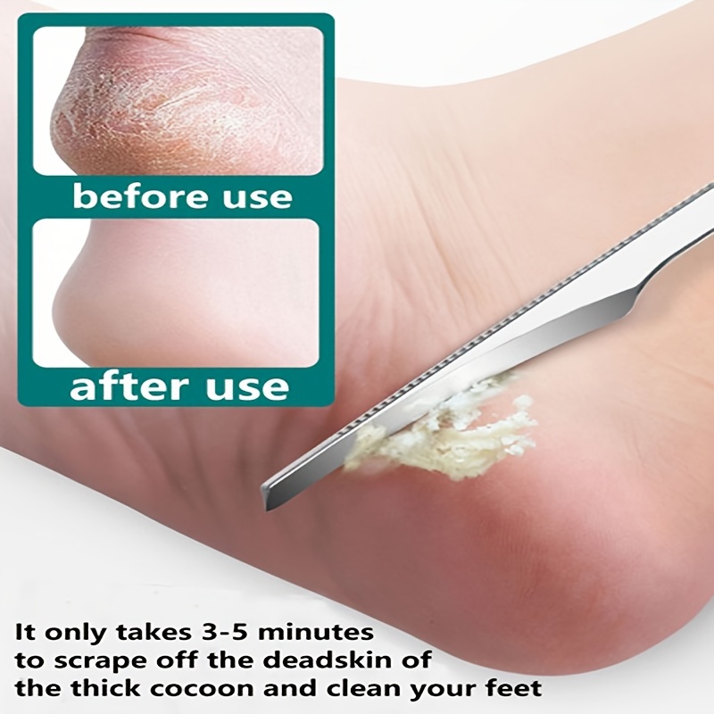 Dead Skin Remove Foot Callus File Exfoliating Tool Heel Cocoon Scraper  Reusable