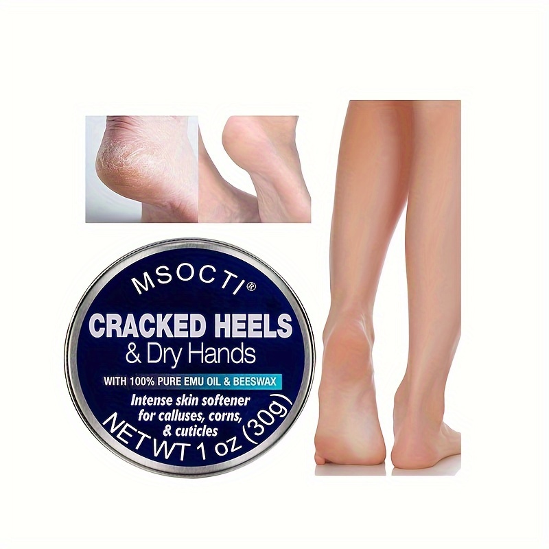 Blue Goo Cracked Heel Foot Softener