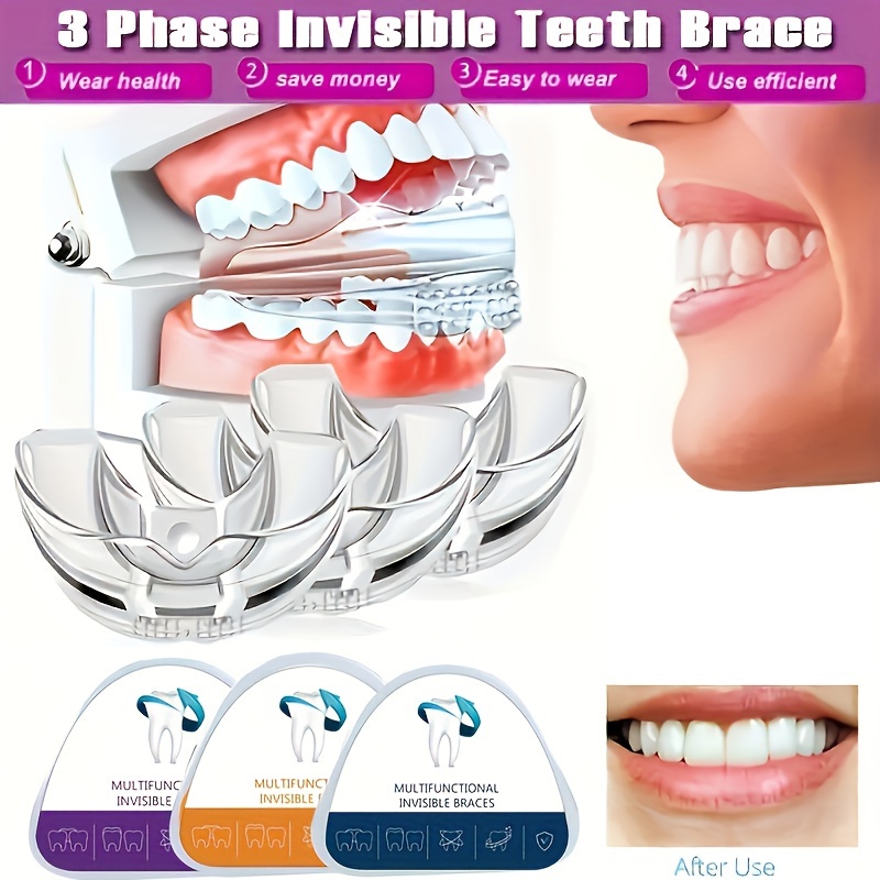 1pcs Protecteur de dents Boxe Protège-dents Brace Boxe Protecteur de dents  Protecteur de dents Sports Brace Orthodontique Appliance Trainer