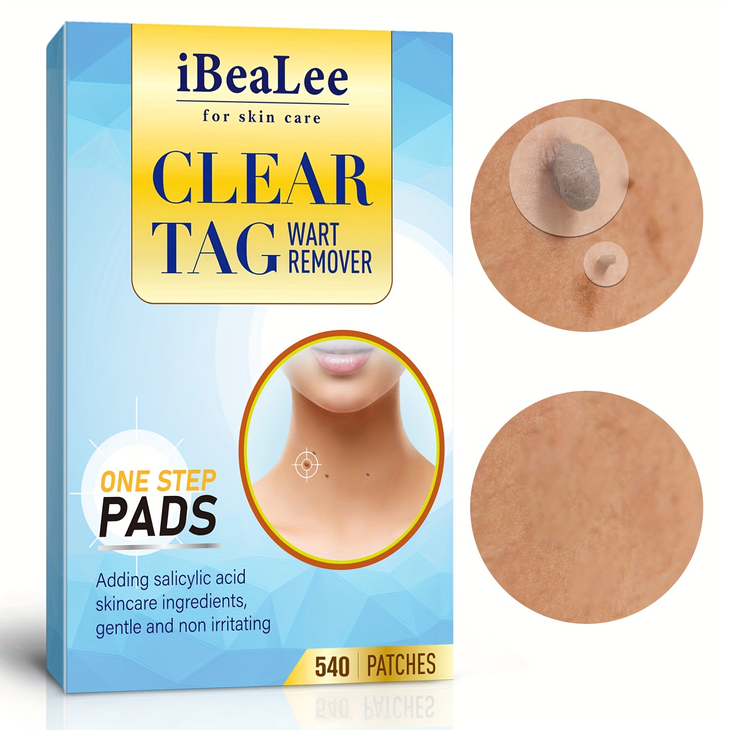 Tags Moles Remover Pen For Face Body, Mole Remover Fast Easy Effective In 5  Days Easy To Remove Tags, Moles, Warts