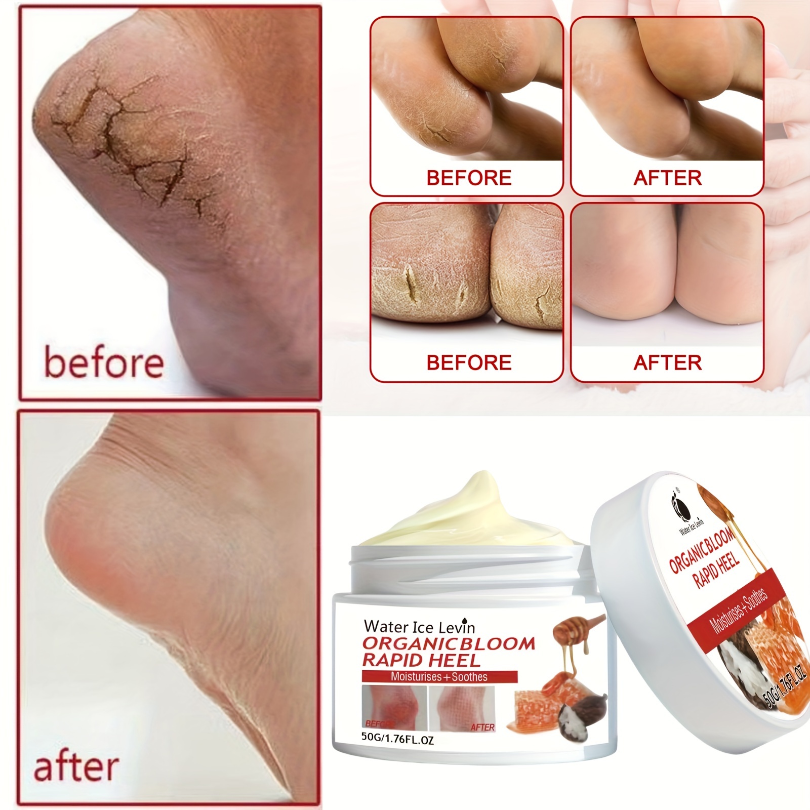 Horse Oil Foot Cream callus Removal Balm moisturize And - Temu