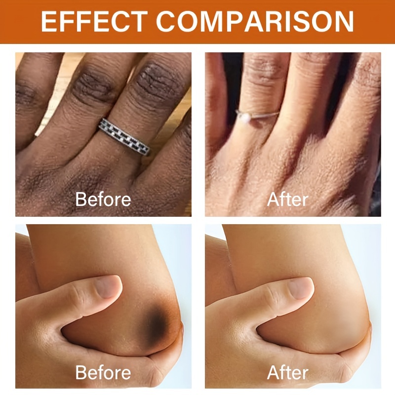 Essence Dark Spots Removal Hydrating Serum for Dark Spots