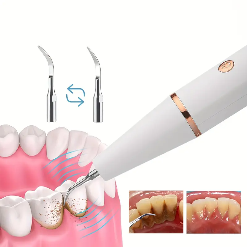 Teeth Cleaner For Teeth Cleaning Tool Kit, Electric Oral Cleaner , With Replaceable Cleaning Heads details 4