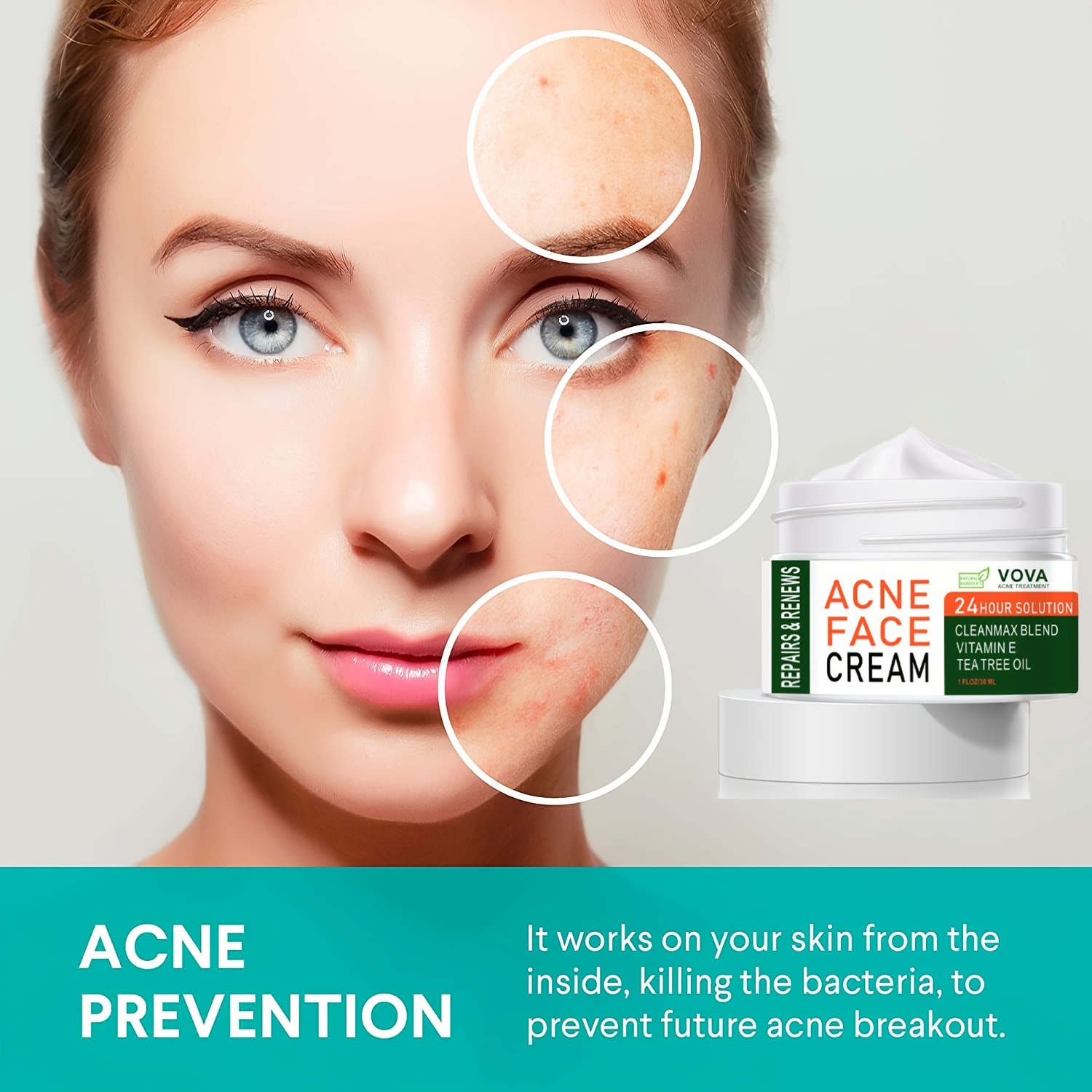 tea tree oil acne scars