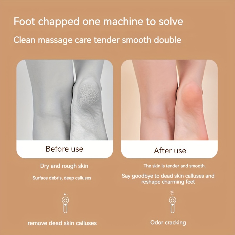 Electric Foot Callus Remover (with Dander Vacuum), Rechargeable