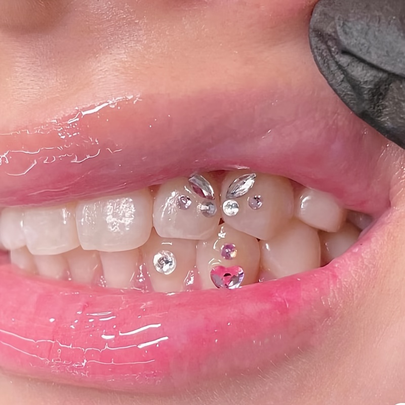 Adorno de Metal para dientes dentales, gemas dentales de varias