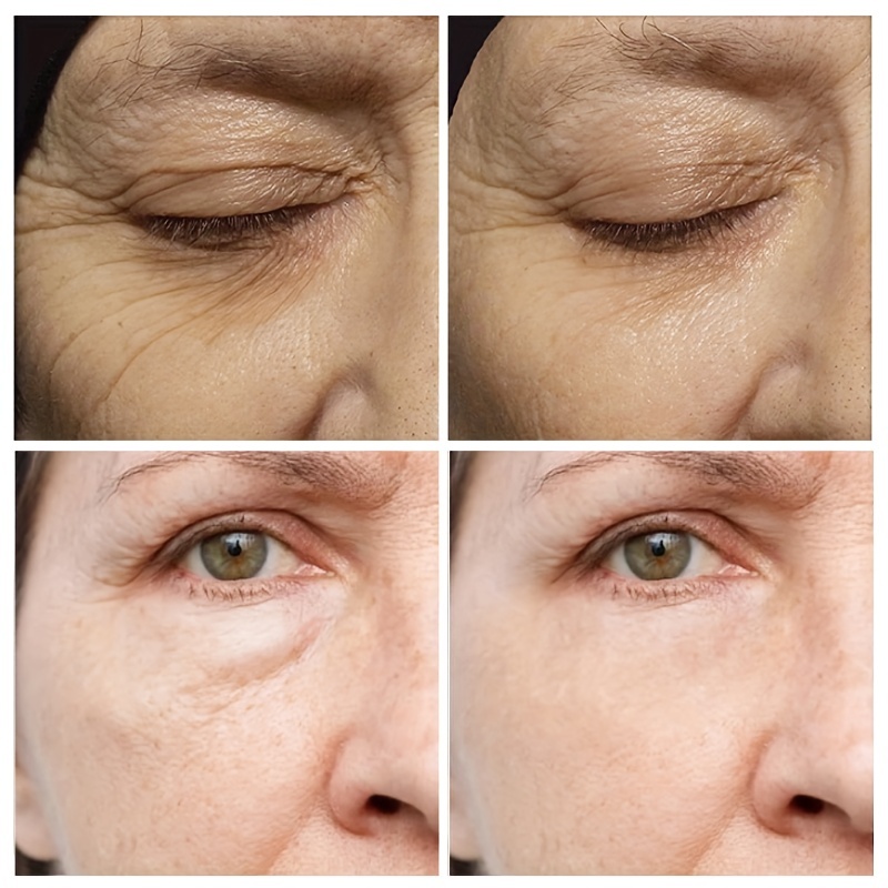 Anti-Aging Eye Cream for Dark Circles and Wrinkles