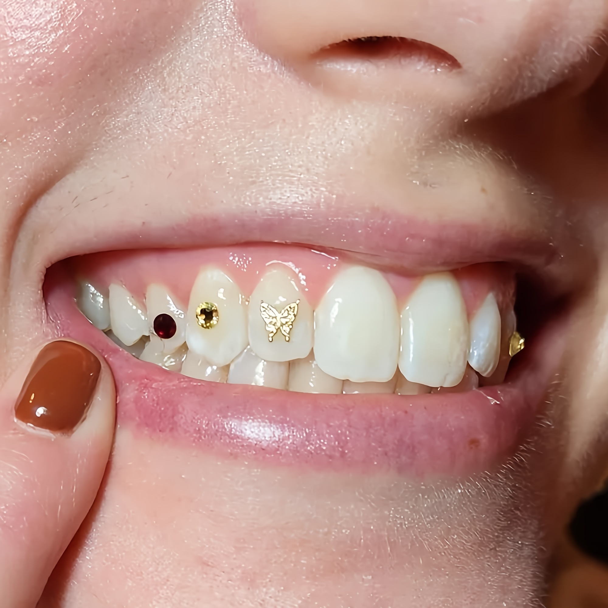 DIY Tooth Gem Glue Crystal Jewelry Glue Dental Self-adhesive Glue for Tooth  Gems Diamond Kit Orthodontic Glue Teeth Decorations - AliExpress