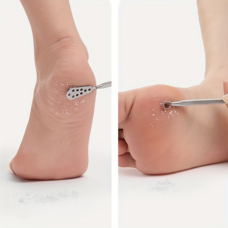 Foot Heel Callus Remover Feet Dead Skin Removal Skin Care Tool