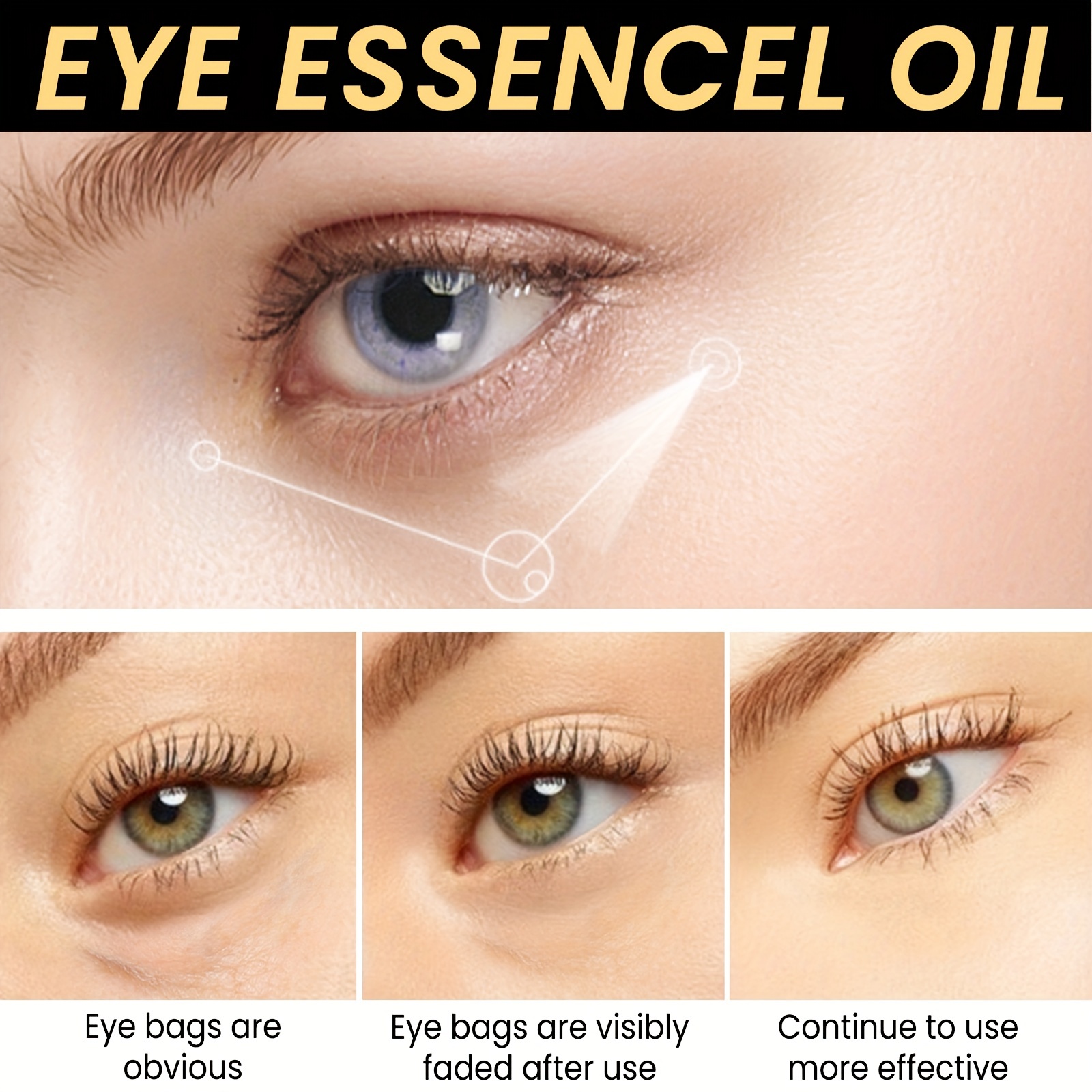 Eye Essence Cream for Dark Circles & Wrinkle Diminishing