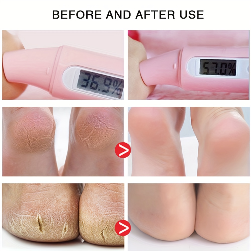 Moisturizing Horse Foot Cream for Dry, Cracked Feet