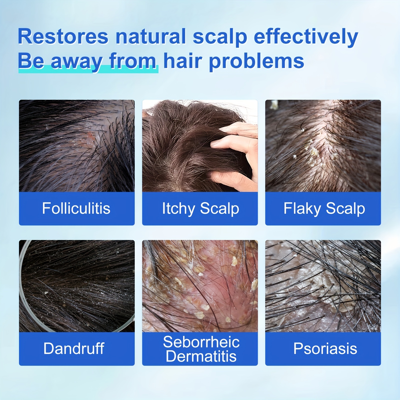 400 Fragrance Hair Shampoo for Dandruff Removal