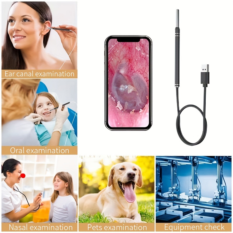 1pc Nettoyeur D'oreille Visuel, Outil De Retrait De Cire D'oreille Otoscope  Sans Fil Avec Endoscope Numérique Étanche 1080P Avec Lumière LED Connexion  Wifi - Temu Belgium