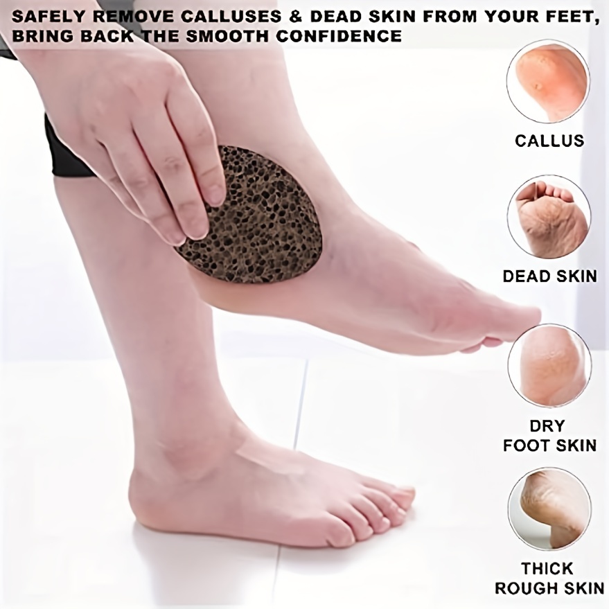 Hard skin callus remover foot scrub - Foot dead skin remover