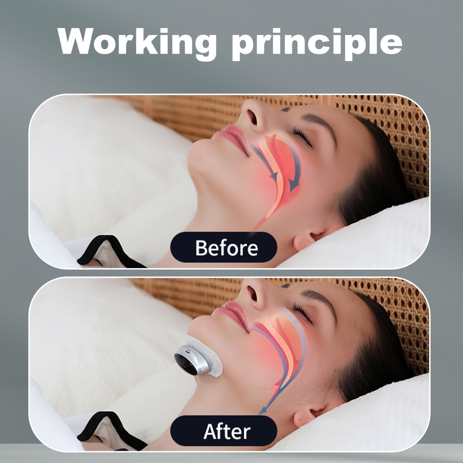 Masajeador Facial Solución Para Ronquidos Dispositivo