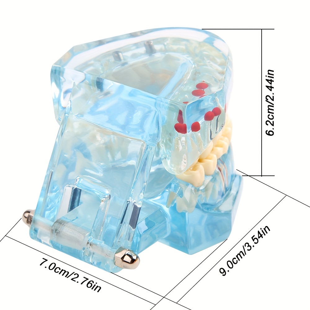 Dental Implant Model, Removable Dental Restoration Model