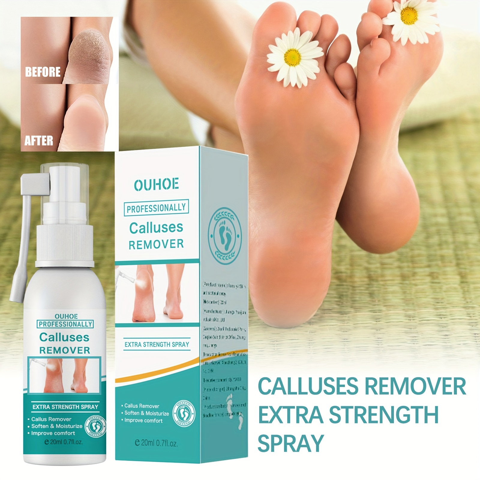 Foot Callus Removal Spray 1.01 Oz Dry Feet Skin Remover Foot Care