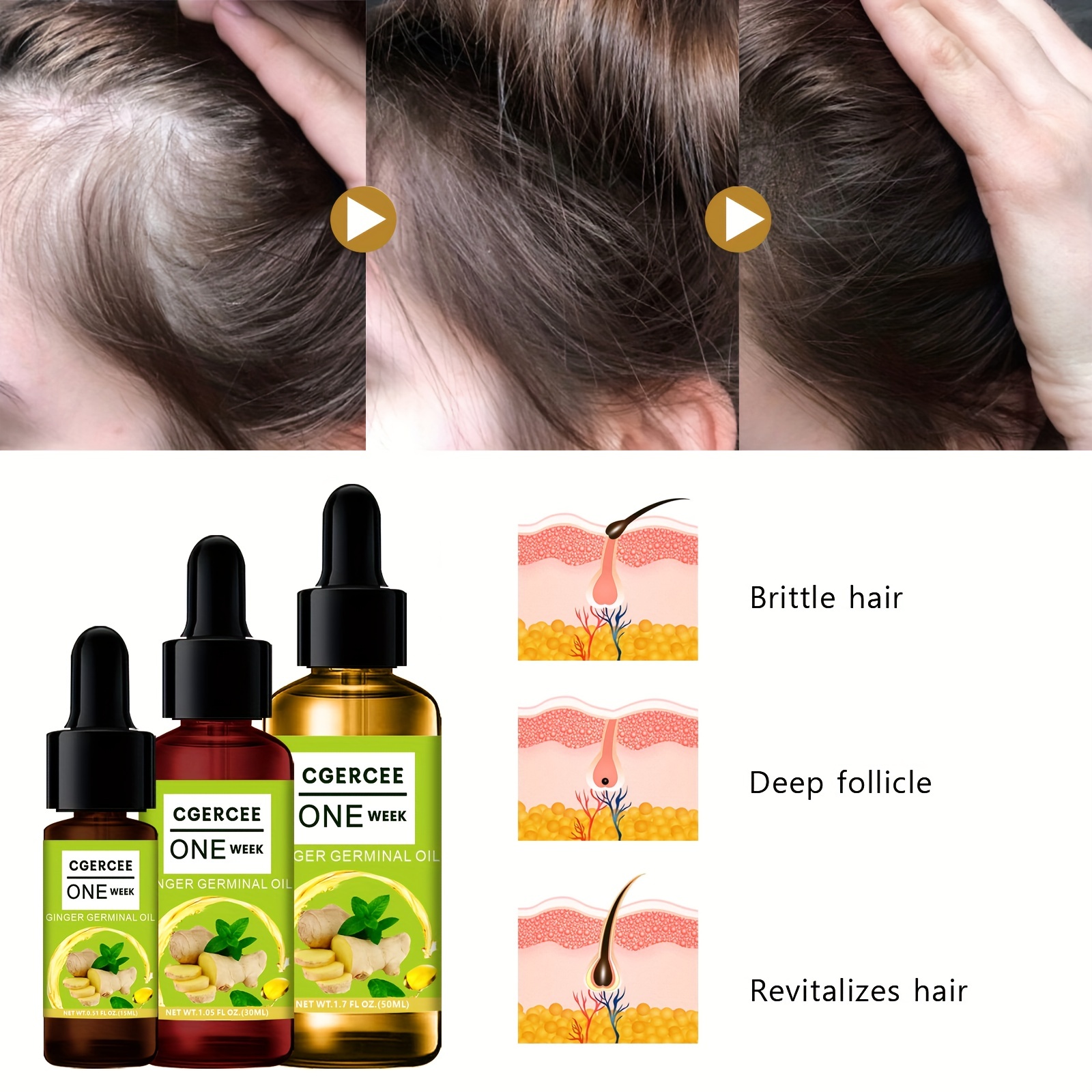 Ginger Hair Care Serum For All Hair Types