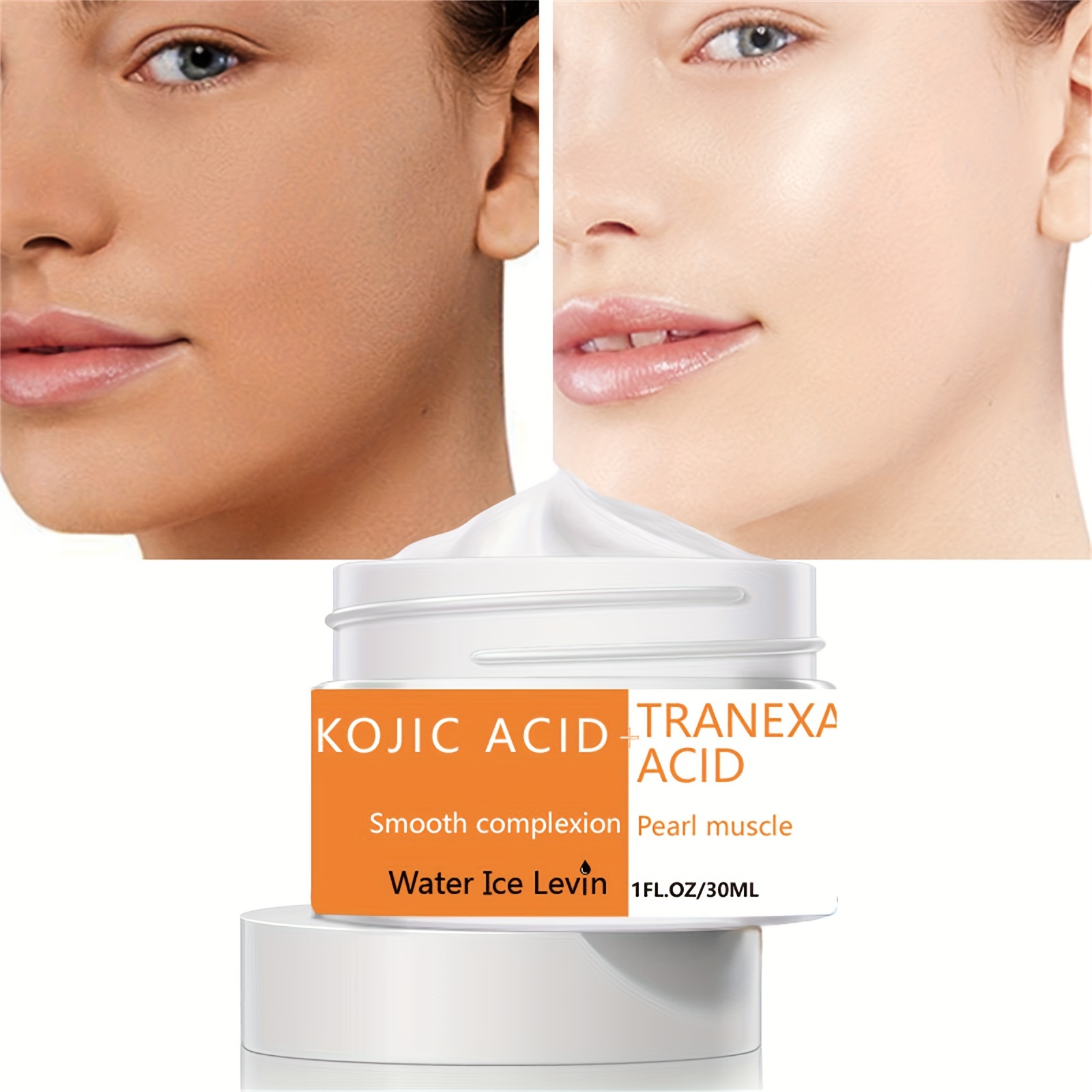 kojic acid before and after