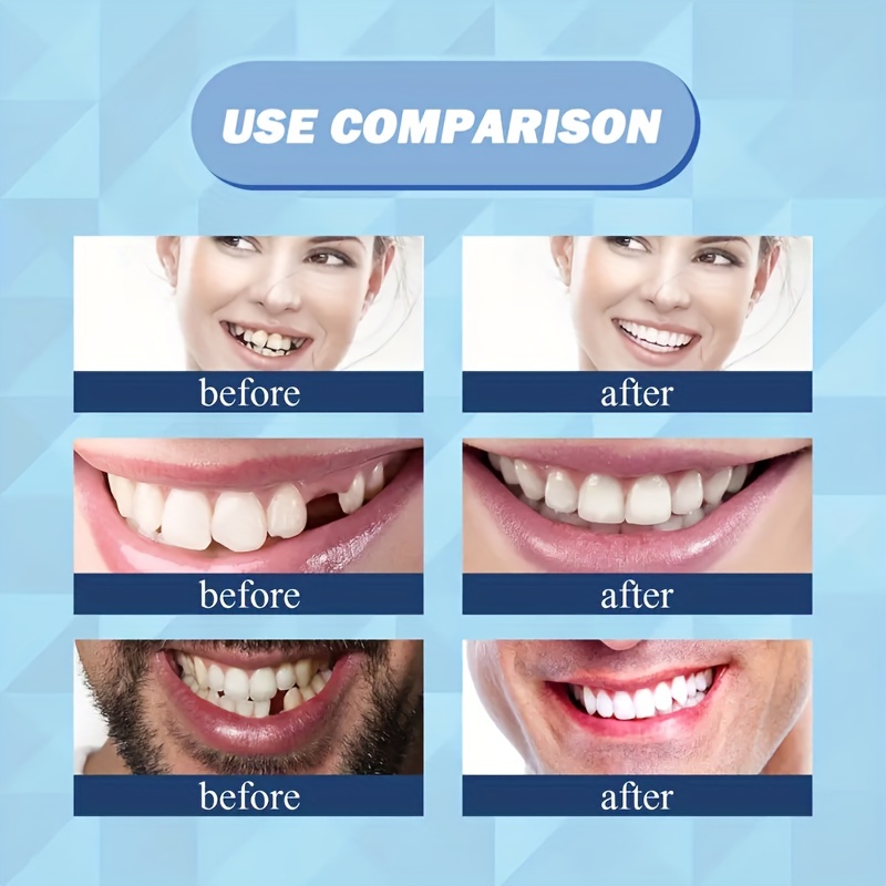 EELHOE denti finti colla solida Kit di riparazione dentale temporaneo  raccordo termico modellabile denti Pellet adesivo
