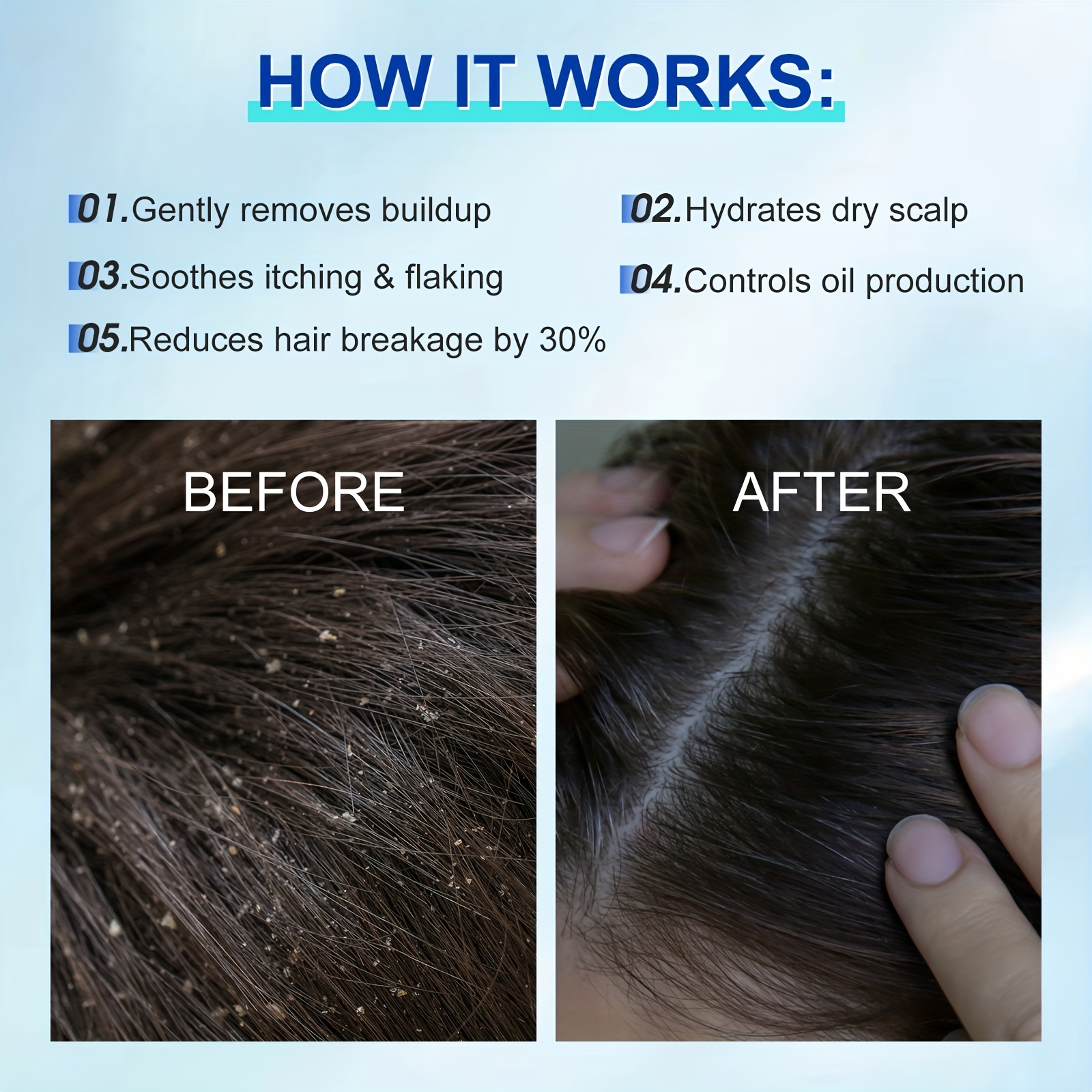 400 Fragrance Hair Shampoo for Dandruff Removal