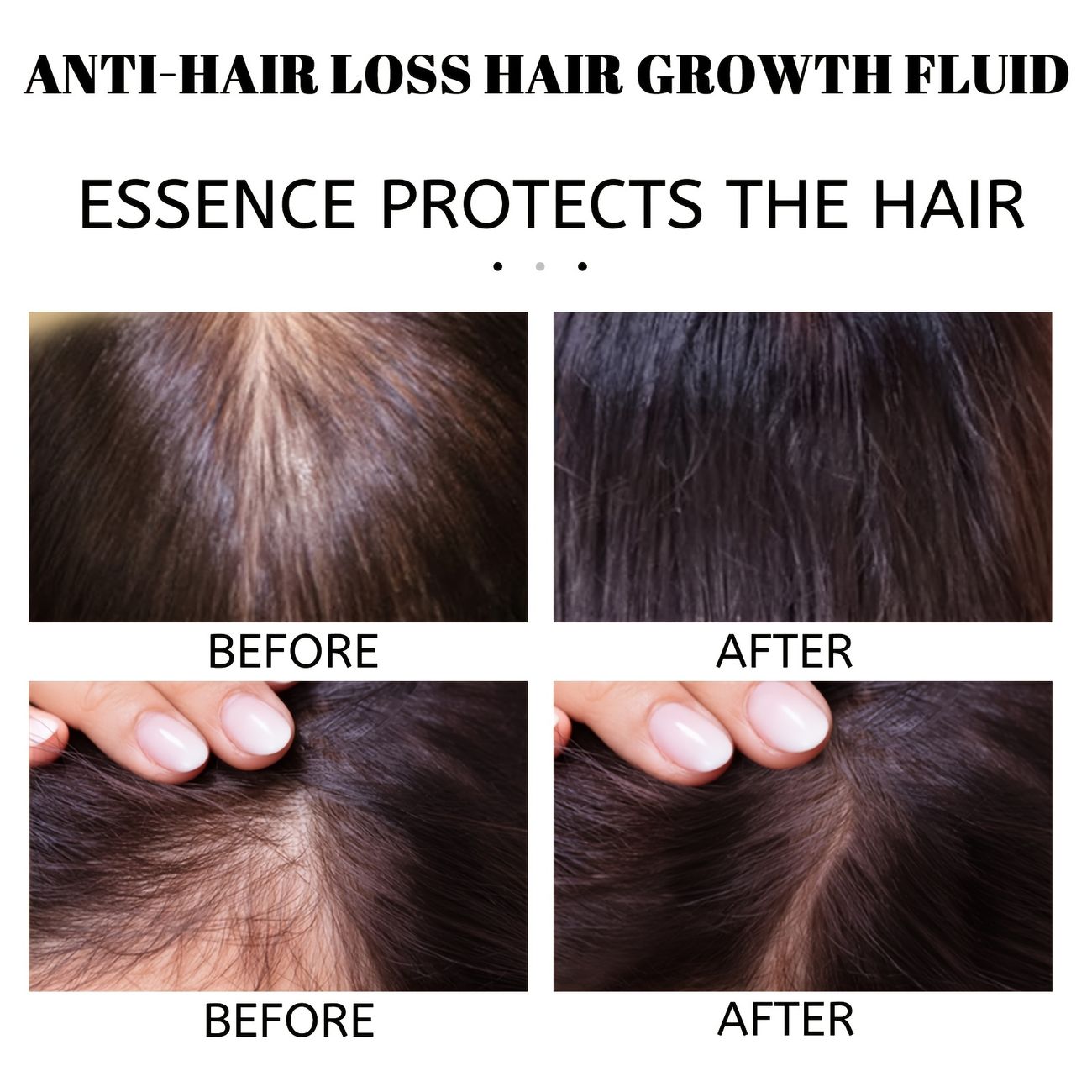 Hair Treatment Spray Ginger Hair Care Essence Hair Care Serum Spray Hair Care Products For Men And Women - Beauty & Personal Care - Temu Hair Treatment Spray Ginger Hair Care Essence Hair Care Serum Spray Hair Care Products For Men And Women - Beauty & Personal Care - Temu