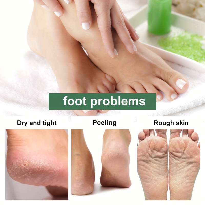 Foot Callus Remover Gel 6oz Callus Remover For Feet & Dead Skin, Foot  Scrubber